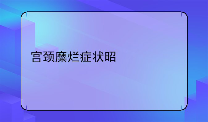 宫颈糜烂症状是什么